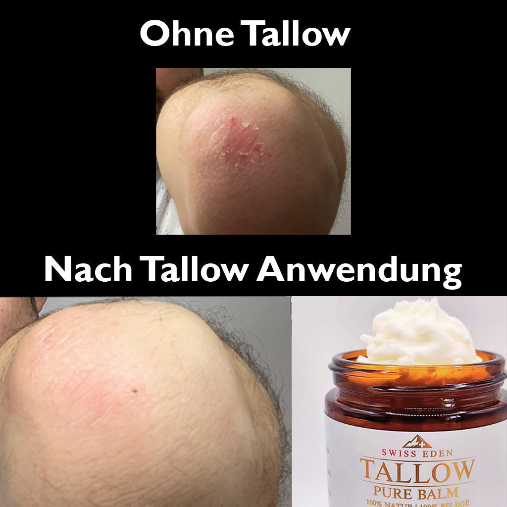 Selbstversuch - Tallow Balm